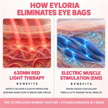Eyloria® 2-in-1 Red Light Therapy + EMS To Erase Eye Bags