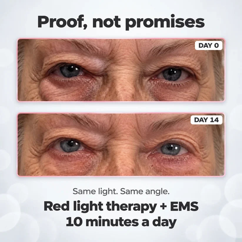 Eyloria® 2-in-1 Red Light Therapy + EMS To Erase Eye Bags